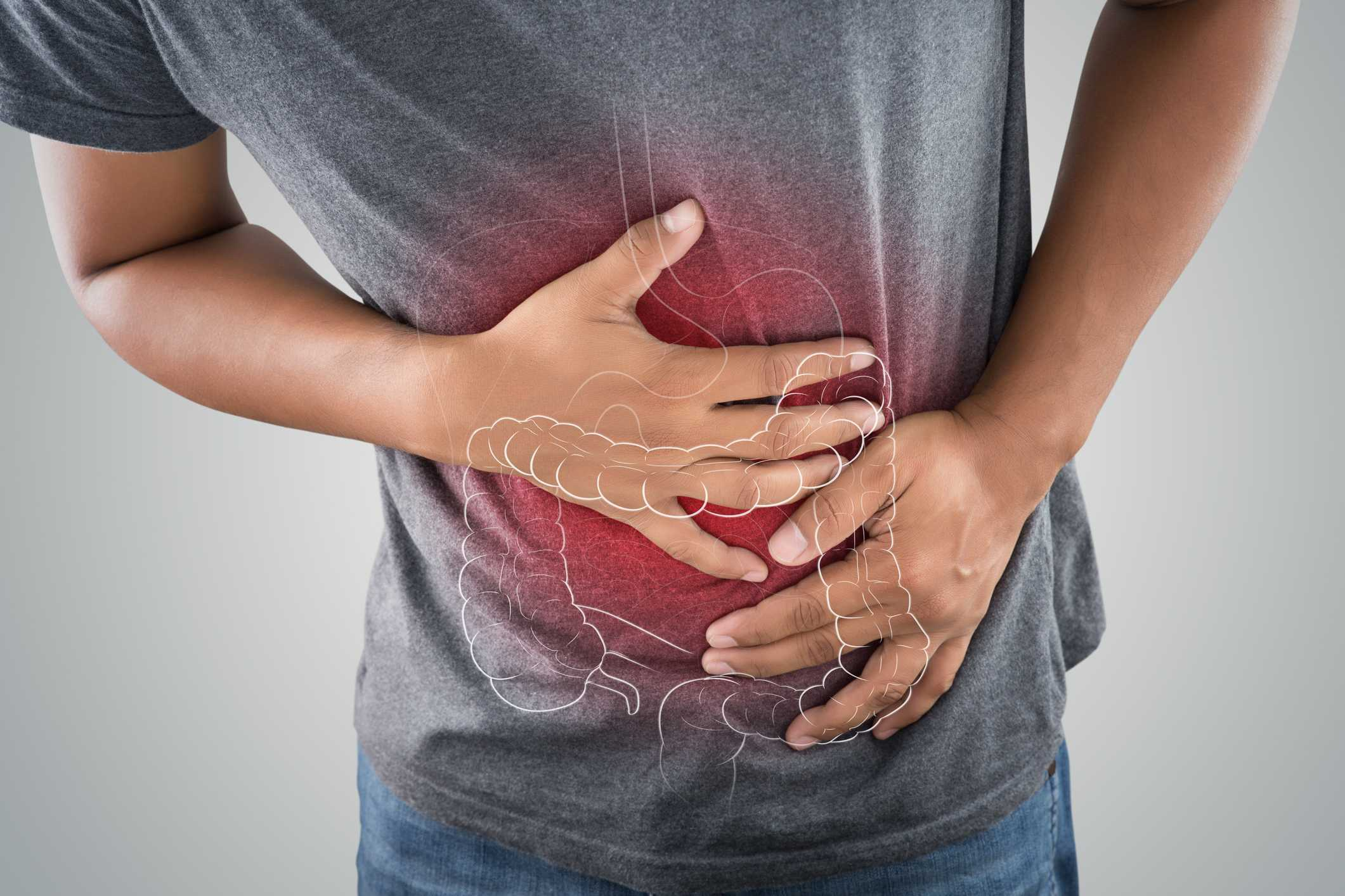 Colon Cancer  Question to Ask